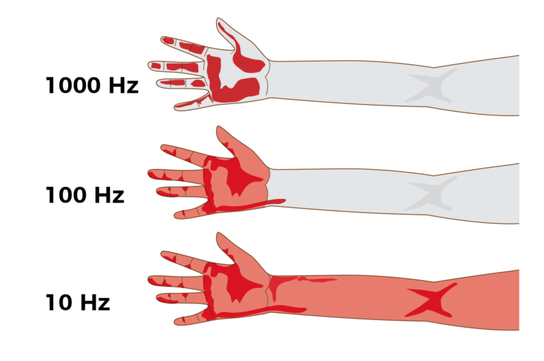 havs hand arm vibration syndrome frequency